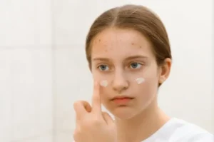 7 Rekomendasi Skincare untuk Kulit Berjerawat